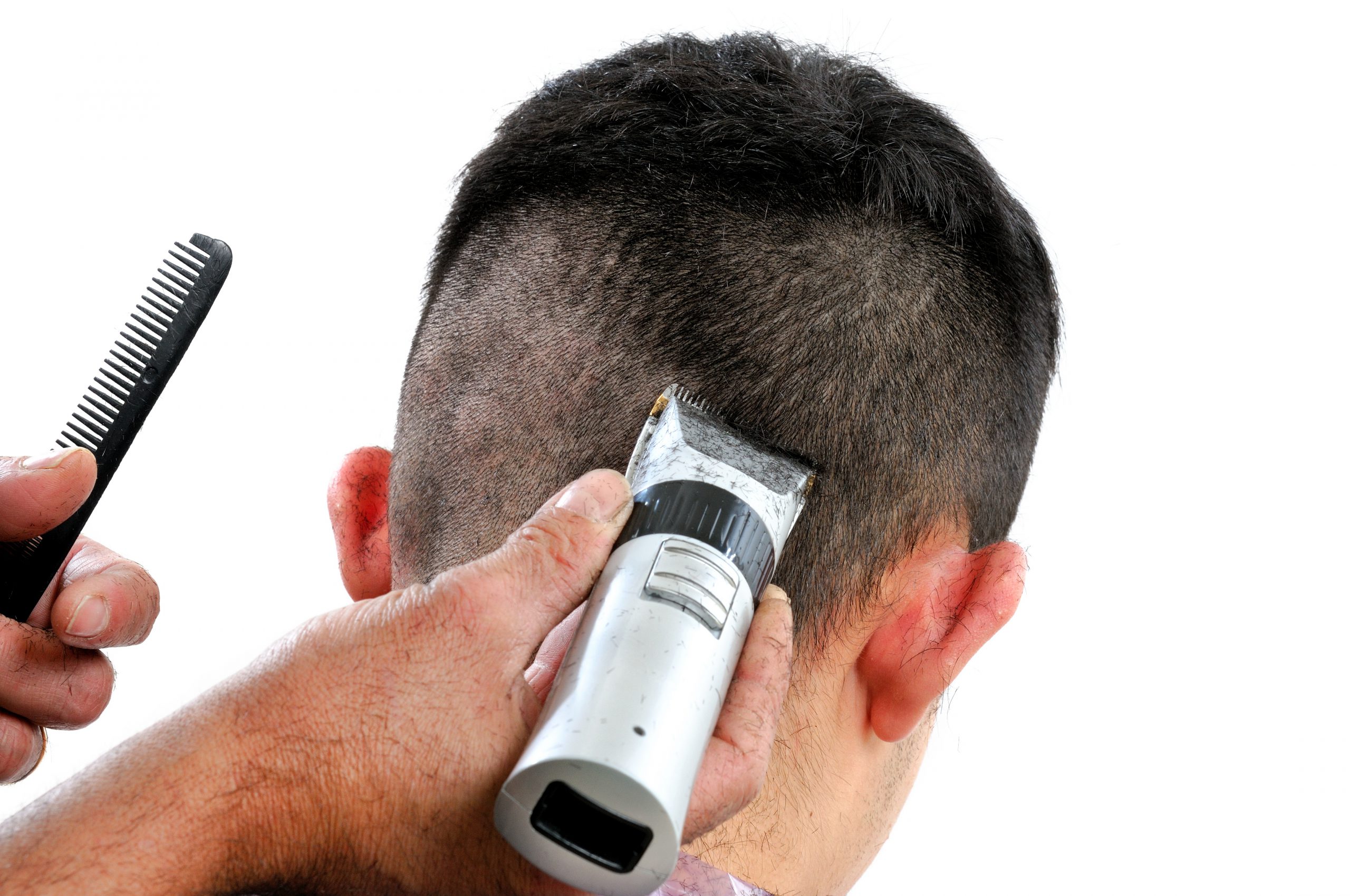 Scalp Micropigmentation Chicago Hair Tattoo Chicago & Beard